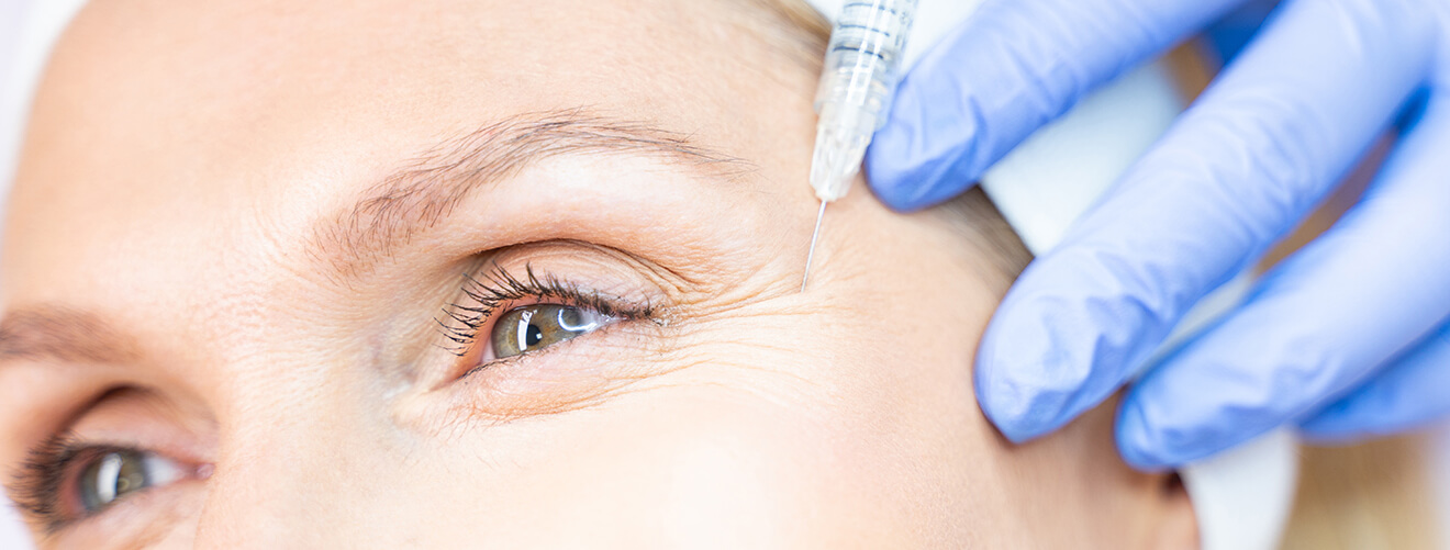 Crow’s Feet Botox in Vancouver, BC