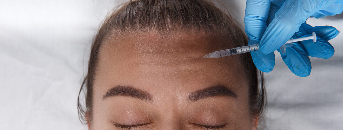 Forehead Lines Botox Vancouver