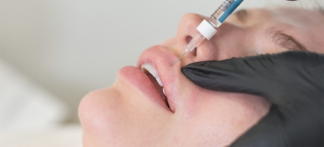 Lip Flip Botox in Vancouver, BC