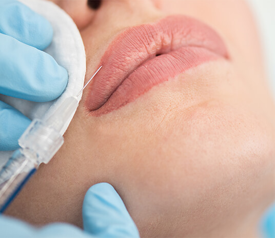 Lip Flip Botox Vancouver