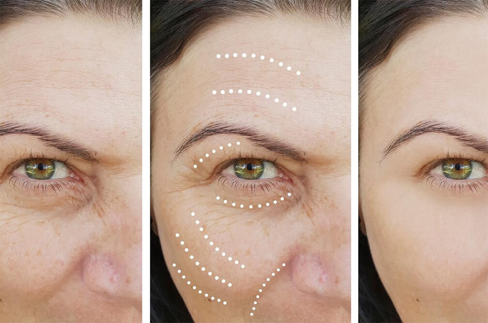 Real Patient Results