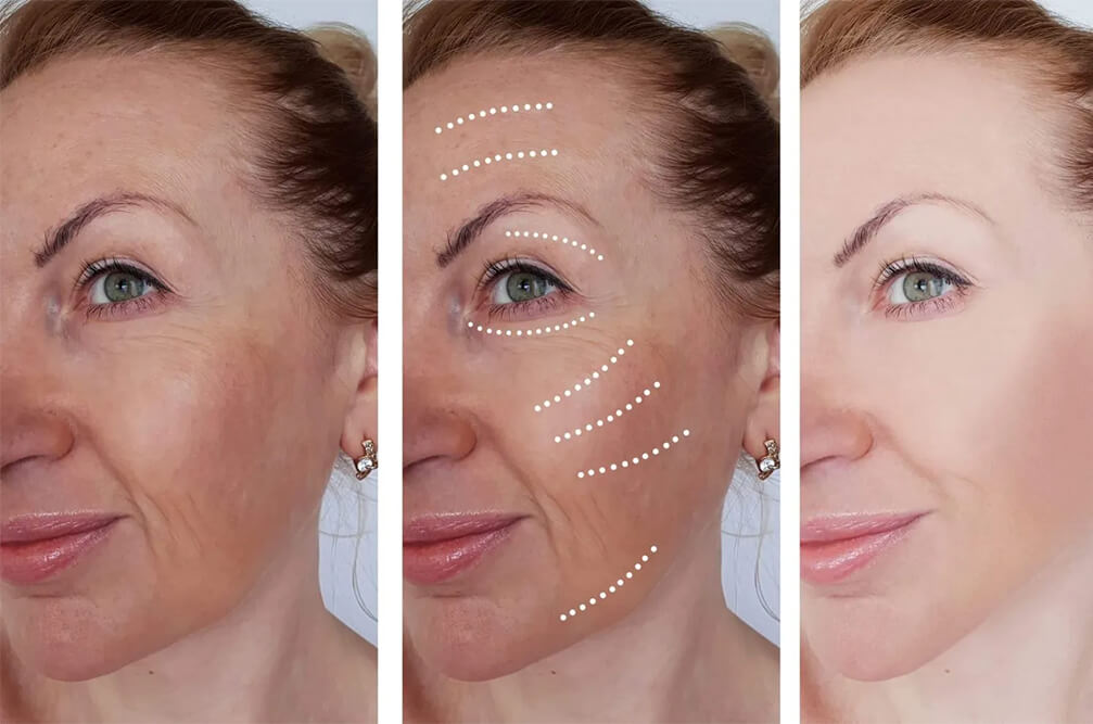 Real Patient Results